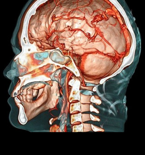 NEUROCIÊNCIAS