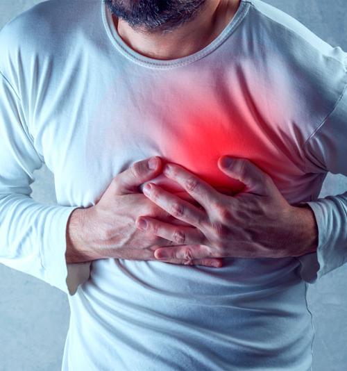 PREVENÇÃO E REABILITAÇÃO CARDIOVASCULAR